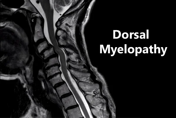 Super Speciality Orthopedics