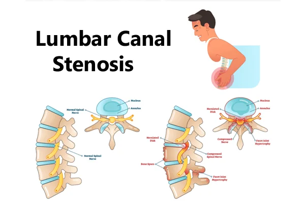 Super Speciality Orthopedics