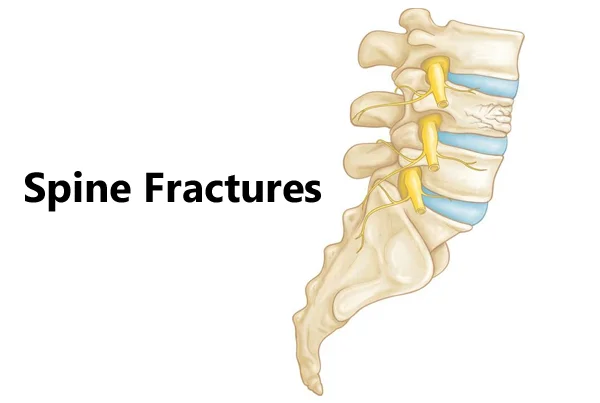 Super Speciality Orthopedics