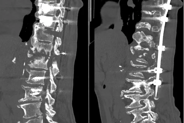 Super Speciality Orthopedics