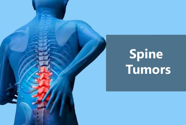 Super Speciality Orthopedics