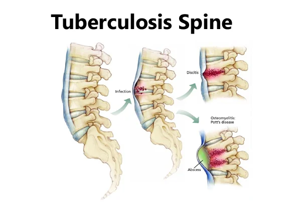 Super Speciality Orthopedics
